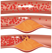 Capillary blood flow
